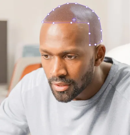 Step 2: Select hairline style from pre-made templates or create custom SMP hairline design