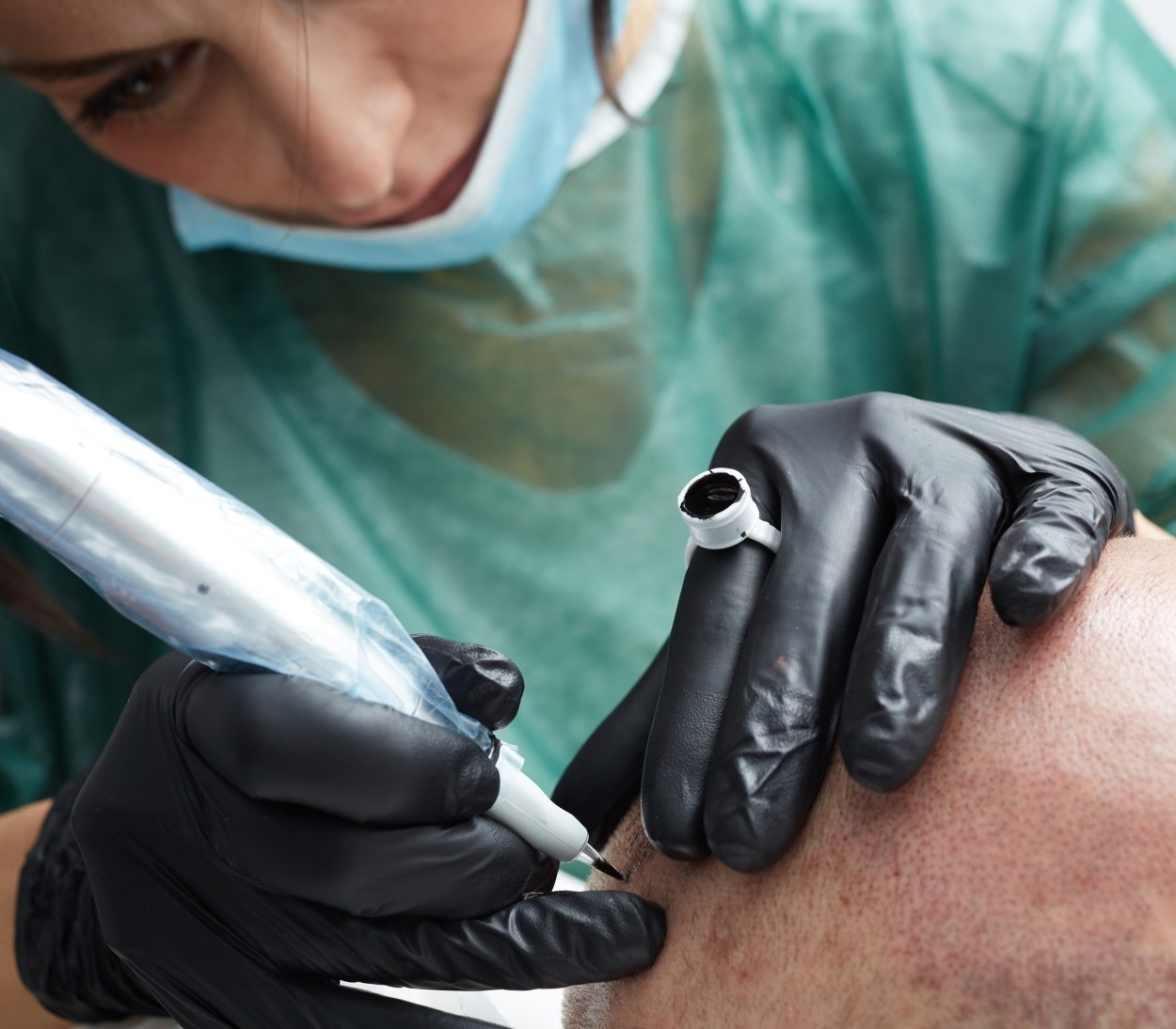 SMP practitioner applying scalp micropigmentation treatment with professional equipment