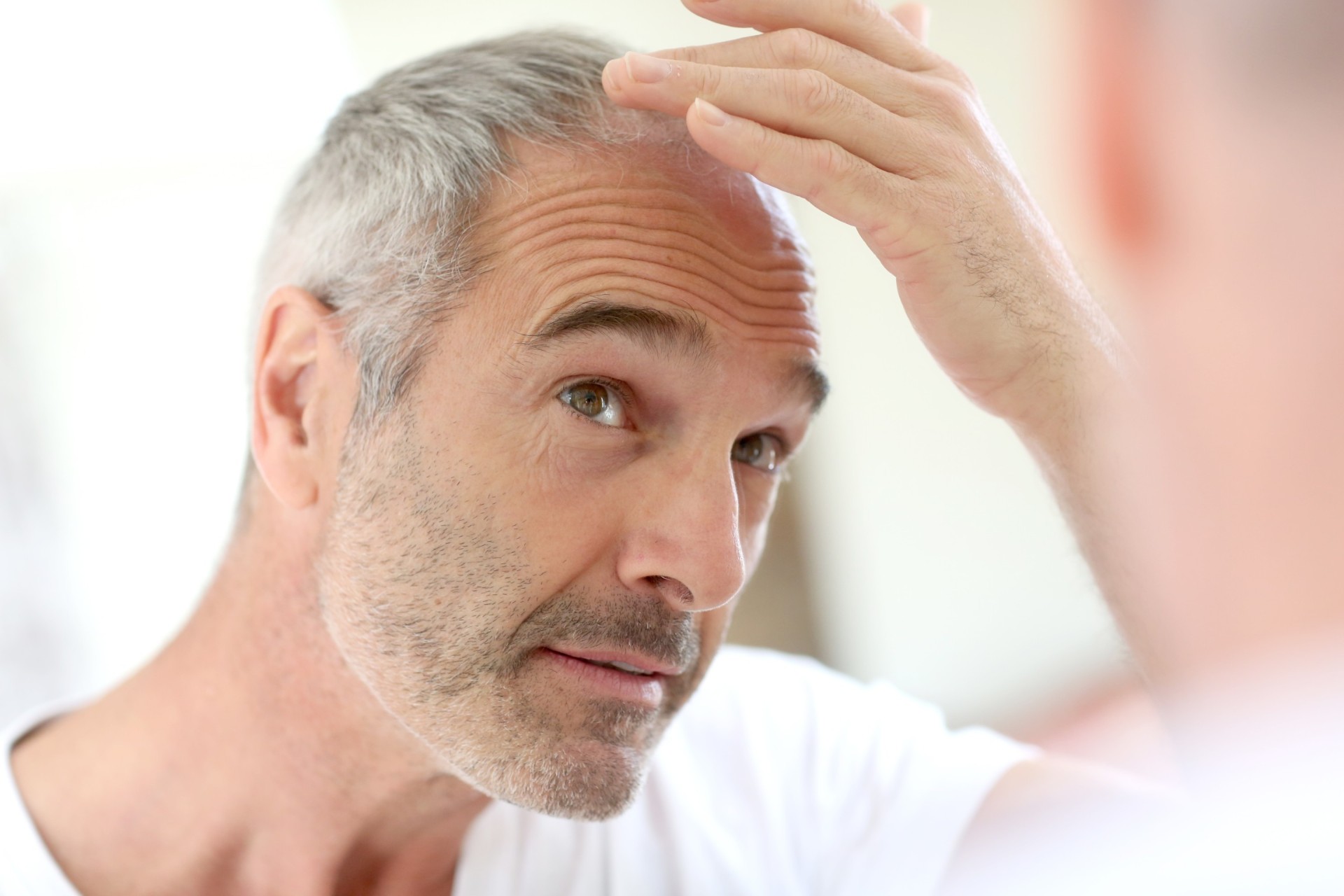 Man examining his receding hairline in the mirror, considering scalp micropigmentation treatment
